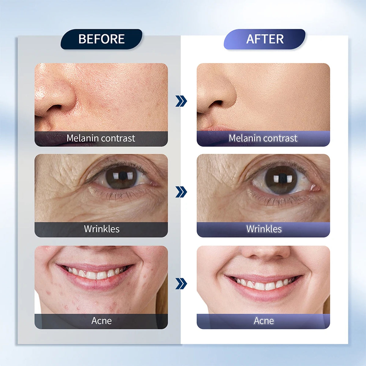 CanbiMart Seven LED Colour Spectrums Targeting Rejuvenation, Acne, Brightening, And Elasticity