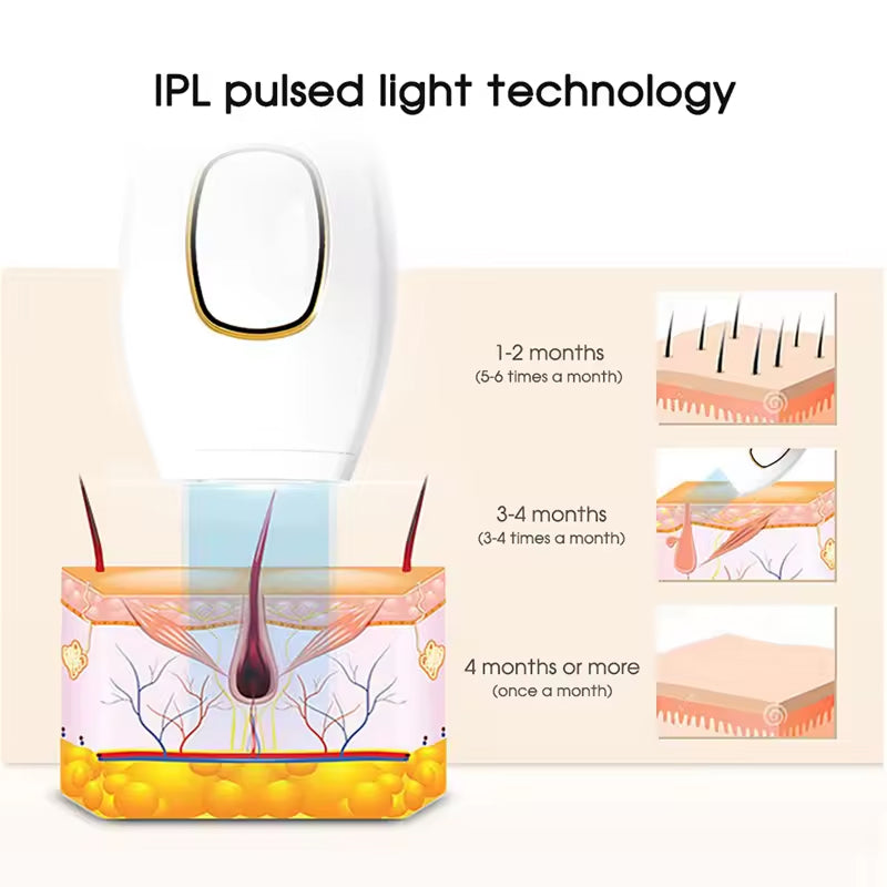 MovixLin IPL Laser Hair Removal Handset for Permanent Smooth Skin