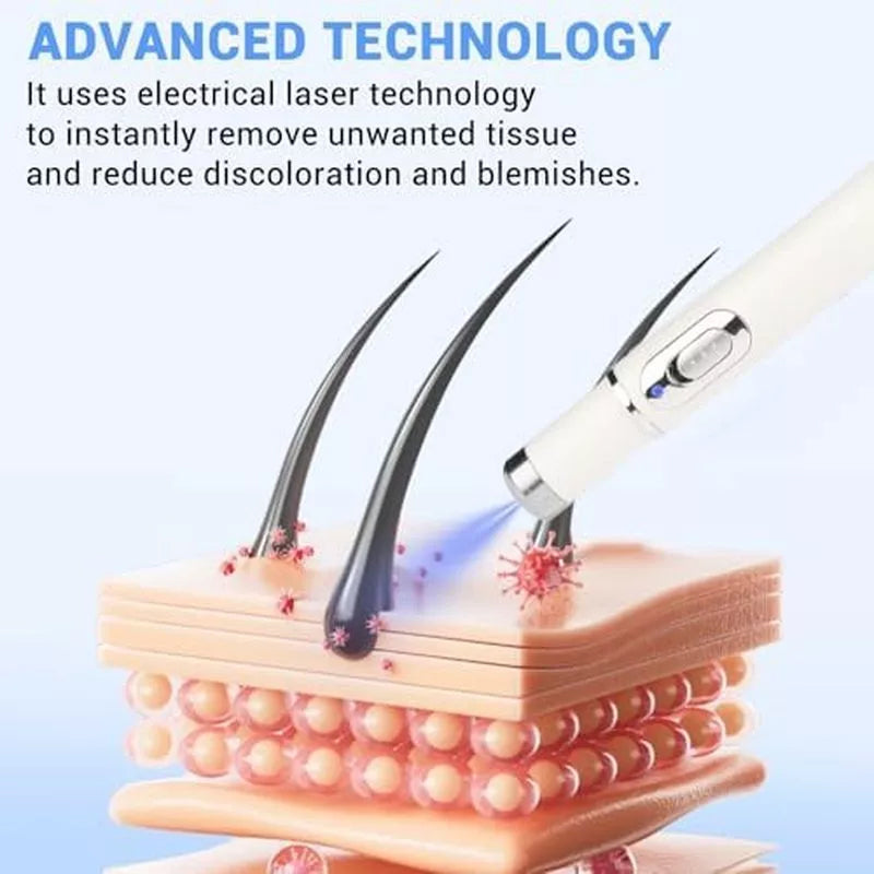 TalfMous Blue Light Technology For Chemical-Free Safe Wart Removal Treatment