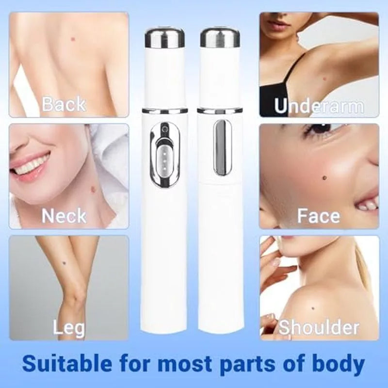 TalfMous Blue Light Technology For Chemical-Free Safe Wart Removal Treatment