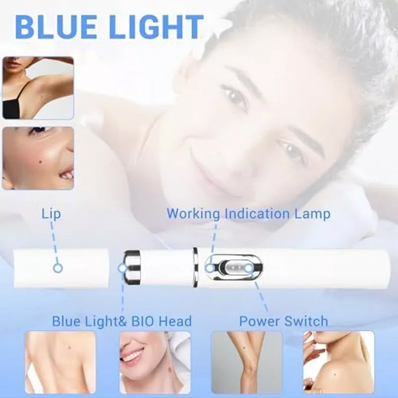 TalfMous Blue Light Technology For Chemical-Free Safe Wart Removal Treatment